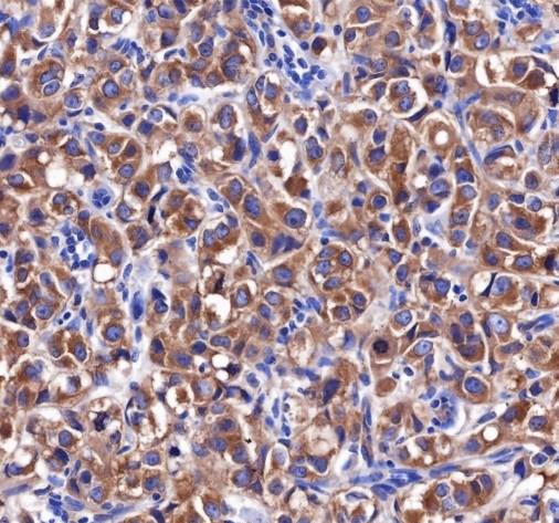 Recombinant PRAS40 Monoclonal Antibody - 2