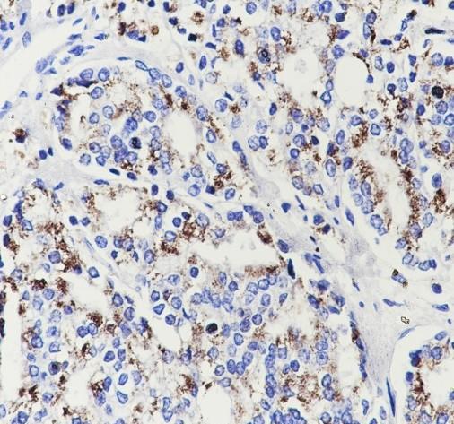 Recombinant SLC45A3 Monoclonal Antibody-searchlist-1