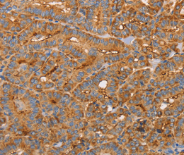 CD59 Polyclonal Antibody - 2