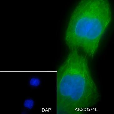Recombinant Keratin 15 Monoclonal Antibody - small - 8