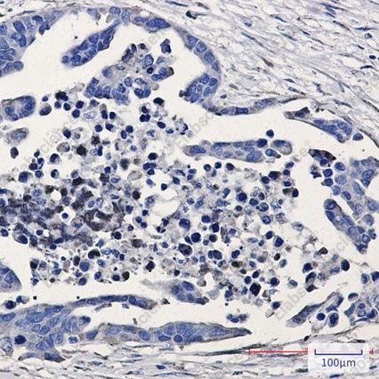 Recombinant GSK3 beta Monoclonal Antibody - 3
