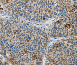 ATG4A Polyclonal Antibody - 2