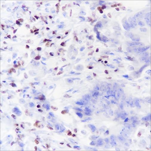 Recombinant IKAROS Monoclonal Antibody - small - 2