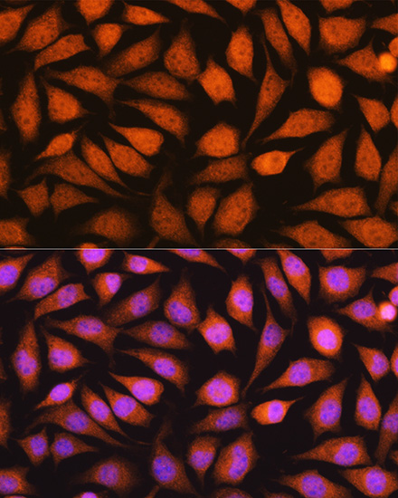 Immunofluorescence analysis of L929 cells using YWHAE Polyclonal Antibody at dilution of  1:100. Blue: DAPI for nuclear staining.