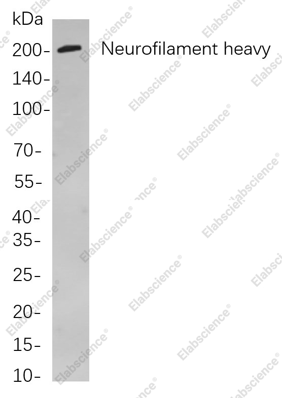 Recombinant Neurofilament heavy polypeptide Monoclonal Antibody - 1