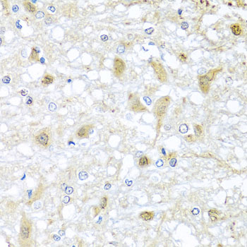 Immunohistochemistry of paraffin-embedded Rat brain using ATP2C1 Polyclonal Antibody at dilution of  1:100 (40x lens).