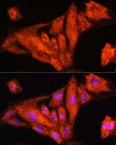 Immunofluorescence analysis of H9C2 cells using RIG-I / DDX58 Polyclonal Antibody at dilution of 1:100. Blue: DAPI for nuclear staining.