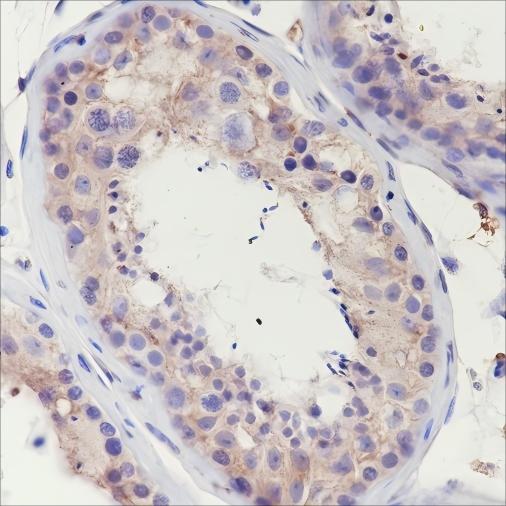 Recombinant ClC-2 Monoclonal Antibody - small - 2