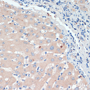 Immunohistochemistry of paraffin-embedded Human liver using DBH Polyclonal Antibody at dilution of  1:200 (40x lens).