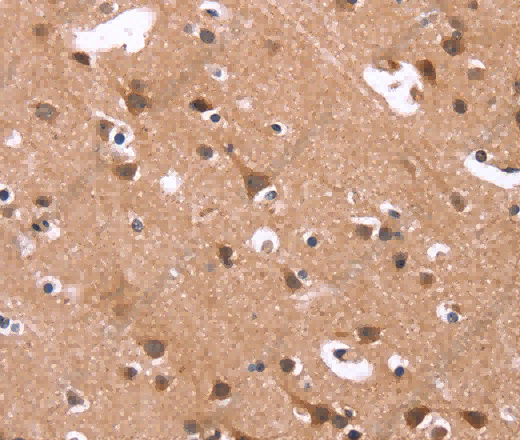 HSD17B1 Polyclonal Antibody - 3