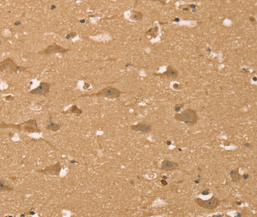 Immunohistochemistry of paraffin-embedded Human brain  using HIF1AN Polyclonal Antibody at dilution of 1:40