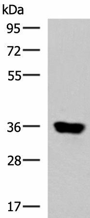 Western blot analysis of Human muscle tissue lysate  using KCNK15 Polyclonal Antibody at dilution of 1:1000