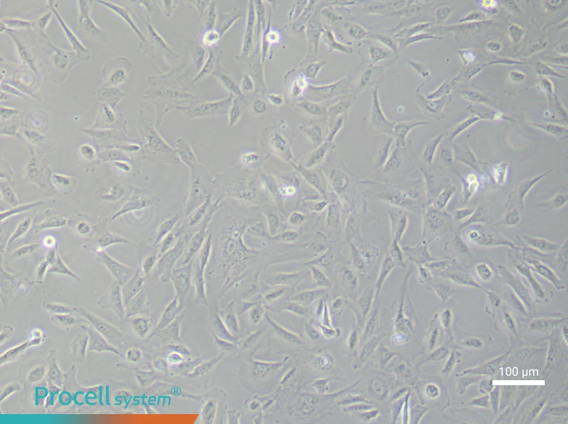 Human Keloid Fibroblast (Primary cell immortalization) Complete MediumHuman Keloid Fibroblast (Primary cell immortalization) Complete Medium - 3