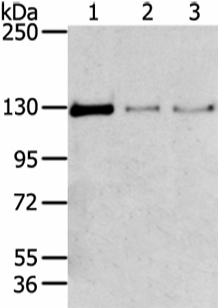 Western Blot analysis of 293T, 231 and lo2 cell using TRIM24 Polyclonal Antibody at dilution of 1/400