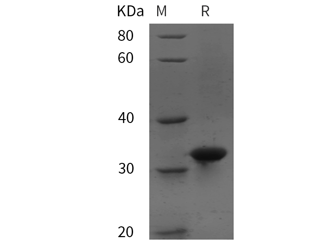 Recombinant Human IL-5 Protein(Fc Tag)-产品推荐-1