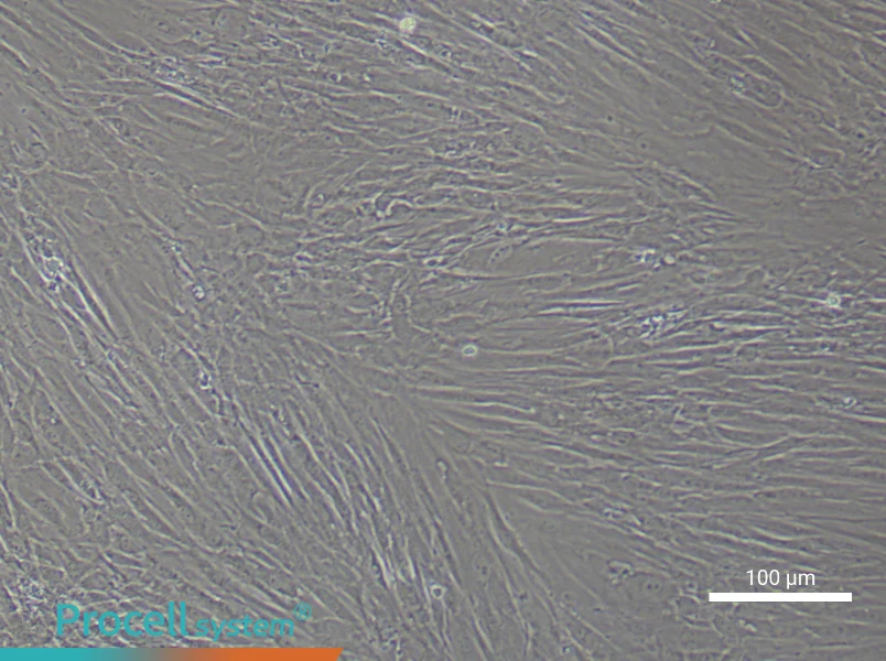 Human Keloid Fibroblast Complete Medium - 1