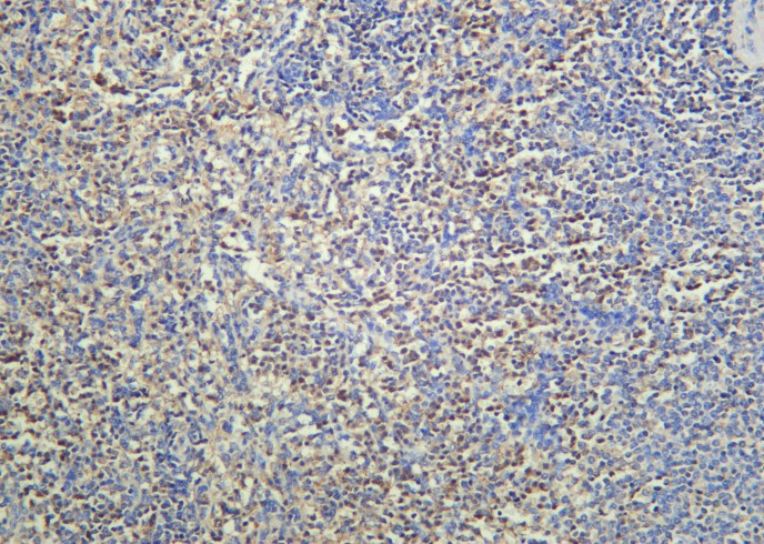 Recombinant cIAP2 Monoclonal Antibody-searchlist-1