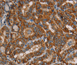 MRPL39 Polyclonal Antibody - 2