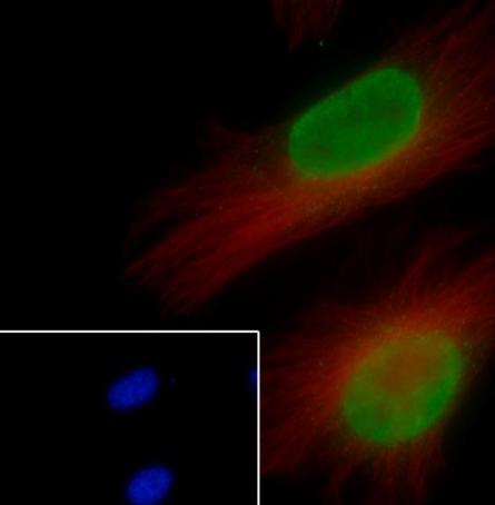 Recombinant Histone H3 (NT) Monoclonal Antibody - small - 5
