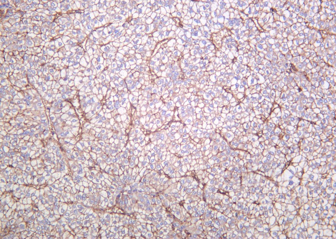 Recombinant Integrin β1 Monoclonal Antibody - small - 3