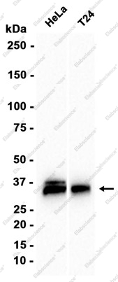Recombinant Cathepsin Z Monoclonal Antibody - 1