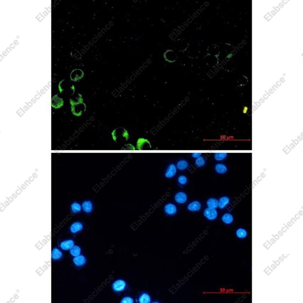 Recombinant PI3 Kinase p85 alpha Monoclonal Antibody - 4