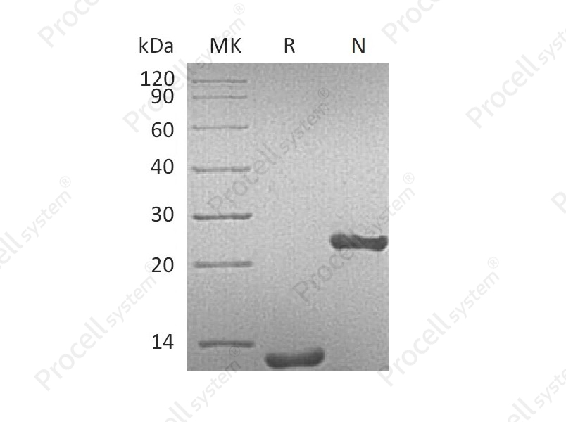 TGFB1/TGF&beta;1/TGF-&beta;1, Human, Recombinant