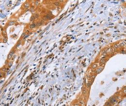 CDK19 Polyclonal Antibody - 3