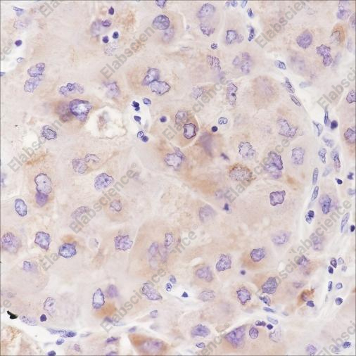 Recombinant ABAT Monoclonal Antibody - 2
