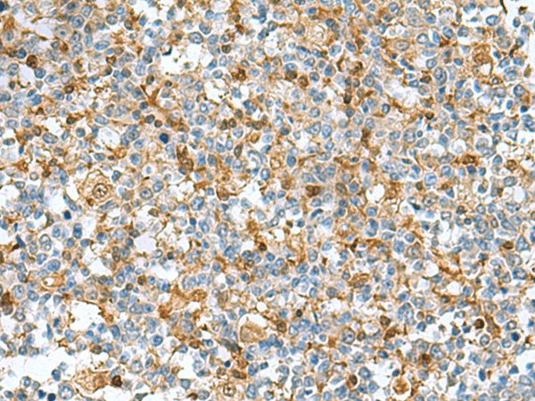 Immunohistochemistry of paraffin-embedded Human tonsil tissue  using DNPH1 Polyclonal Antibody at dilution of 1:55(?200)