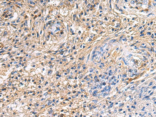 Immunohistochemistry of paraffin-embedded Human brain tissue  using SAV1 Polyclonal Antibody at dilution of 1:90(?200)