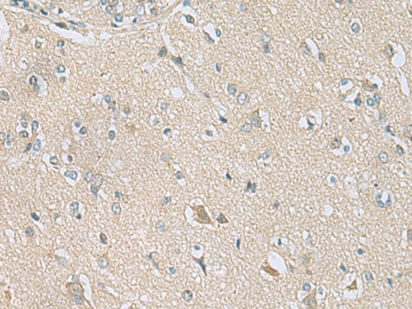 Immunohistochemistry of paraffin-embedded Human brain tissue  using TSTA3 Polyclonal Antibody at dilution of 1:80(?200)