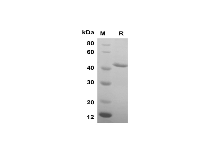 Recombinant Mouse IL1A Protein(GST Tag)-1