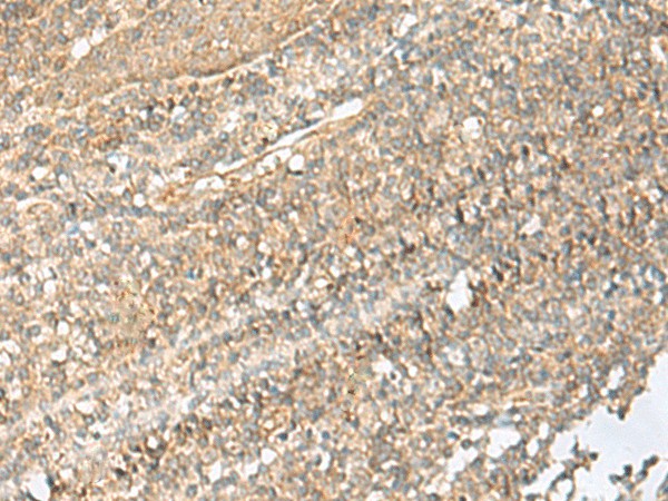 Immunohistochemistry of paraffin-embedded Human tonsil tissue  using NID2 Polyclonal Antibody at dilution of 1:70(?200)