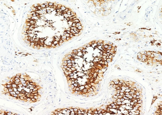 Recombinant ACE2 Monoclonal Antibody - small - 2