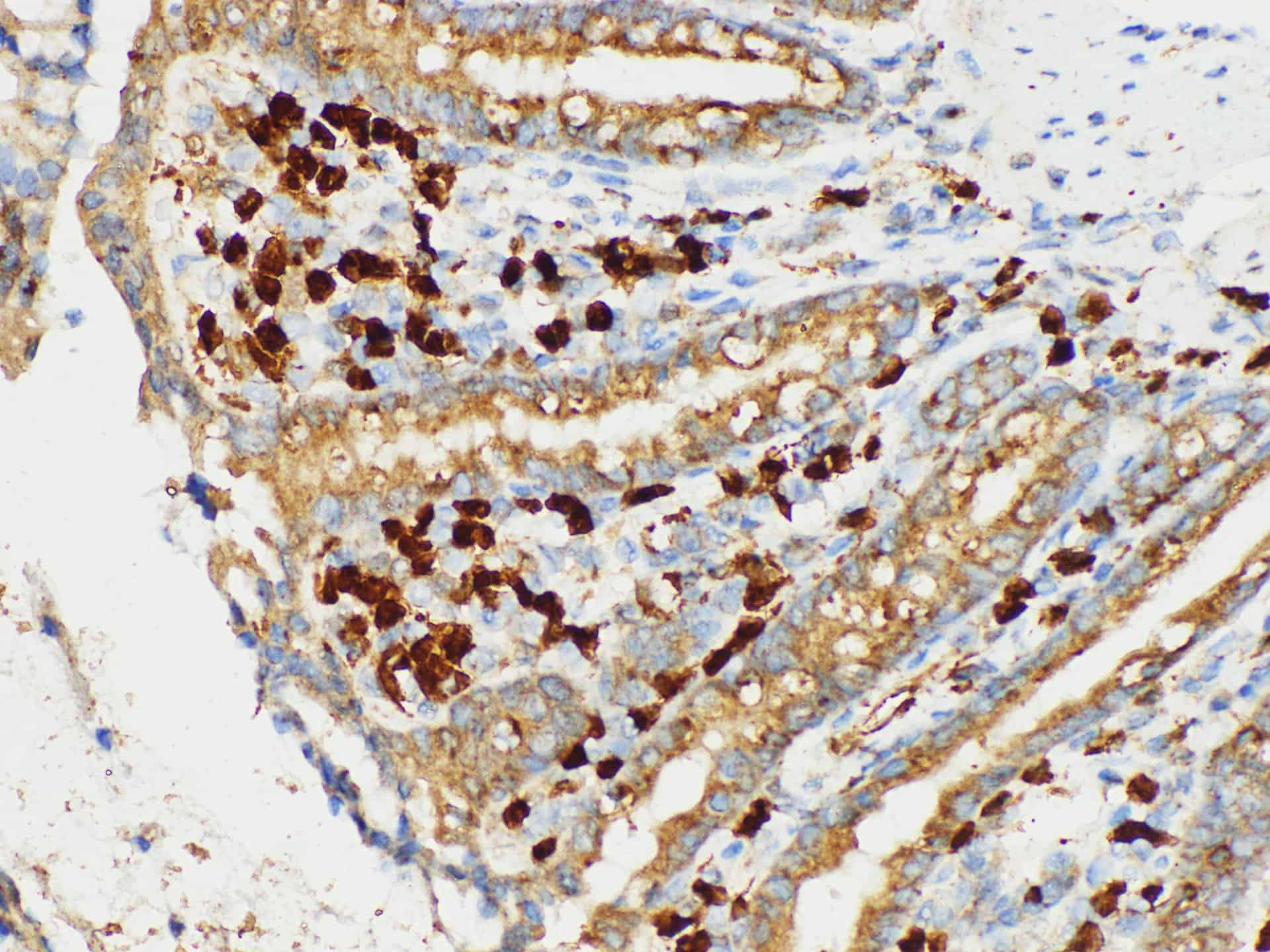 Immunohistochemistry of paraffin-embedded Rat colon using S100A4 Polycloanl Antibody at dilution of 1:50.