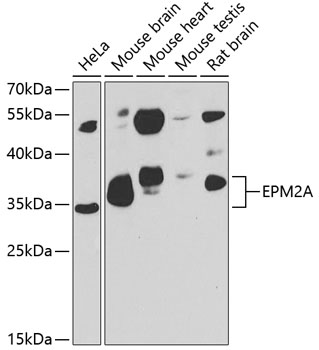 Western blot analysis of extracts of various cell lines using EPM2A Polyclonal Antibody at 1:1000 dilution.