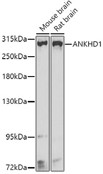 Western blot analysis of extracts of various cell lines using ANKHD1 Polyclonal Antibody at dilution of 1:1000.