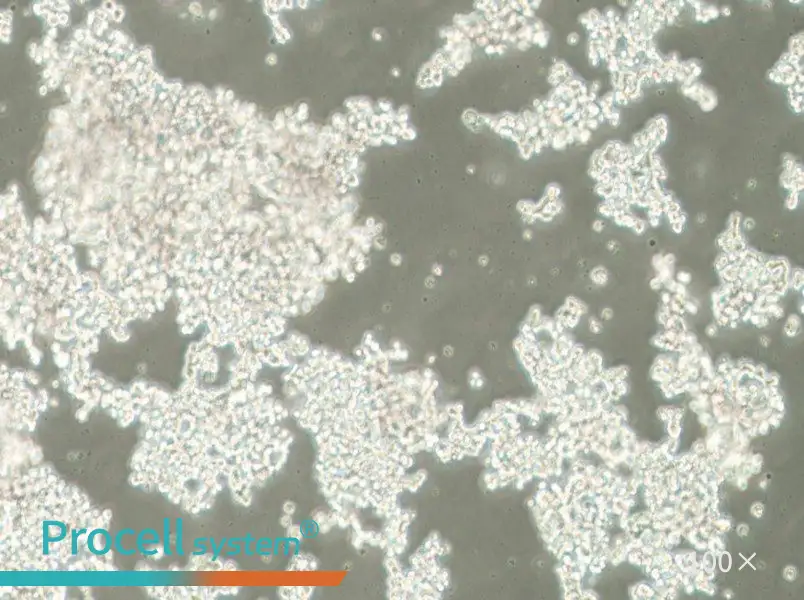 NCI-H82 [H82] Cell Complete Medium - 3