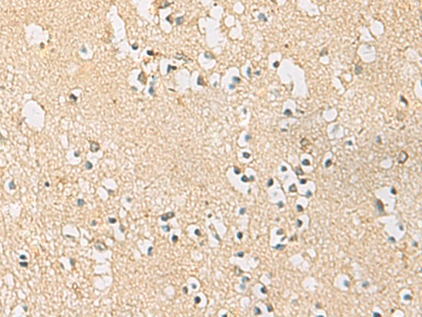 Immunohistochemistry of paraffin-embedded Human brain tissue  using PDE4DIP Polyclonal Antibody at dilution of 1:45(?200)