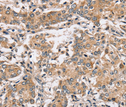 PPP1CC Polyclonal Antibody - 2