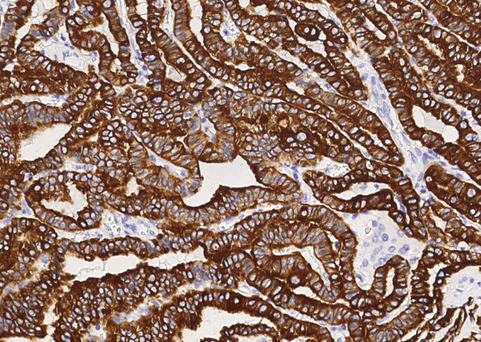 KRT19 Monoclonal Antibody-searchlist-1