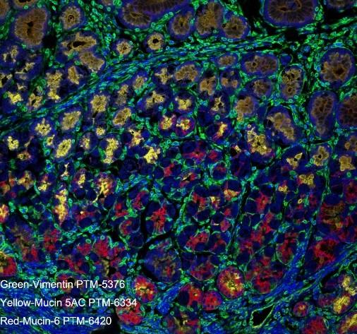 Recombinant Gastric Mucin-6/MUC6 Monoclonal Antibody - small - 3