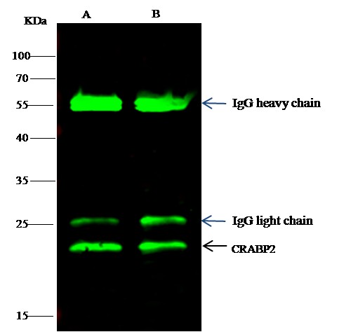 Recombinant CRABP2 Monoclonal Antibody - small - 3