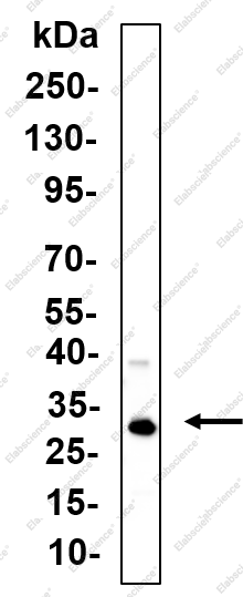 Recombinant NEK7 Monoclonal Antibody - 1