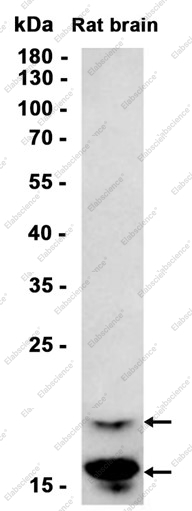 Recombinant Myelin Basic Protein Monoclonal Antibody - 1