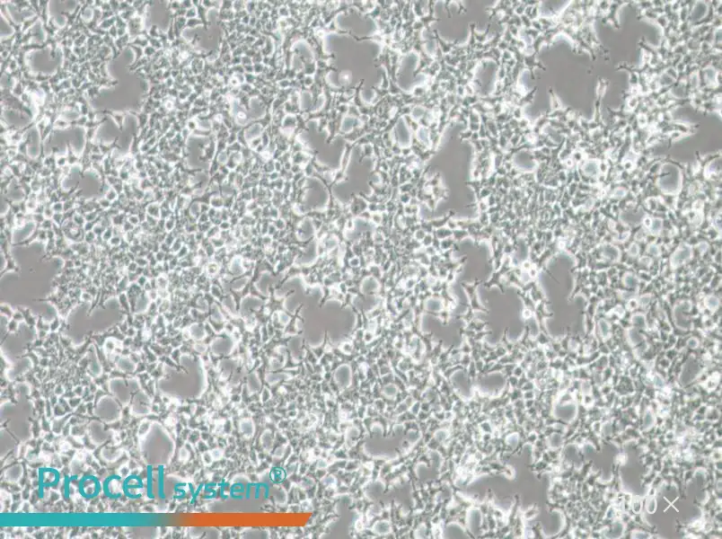 HKb20 Cell Complete MediumHKb20 Cell Complete Medium - 2