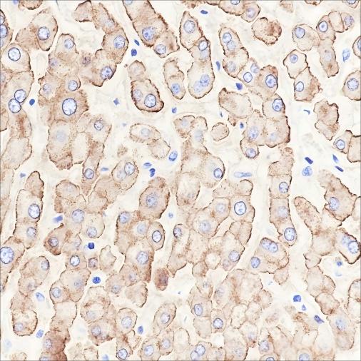 Recombinant ASGR1 Monoclonal Antibody - small - 4