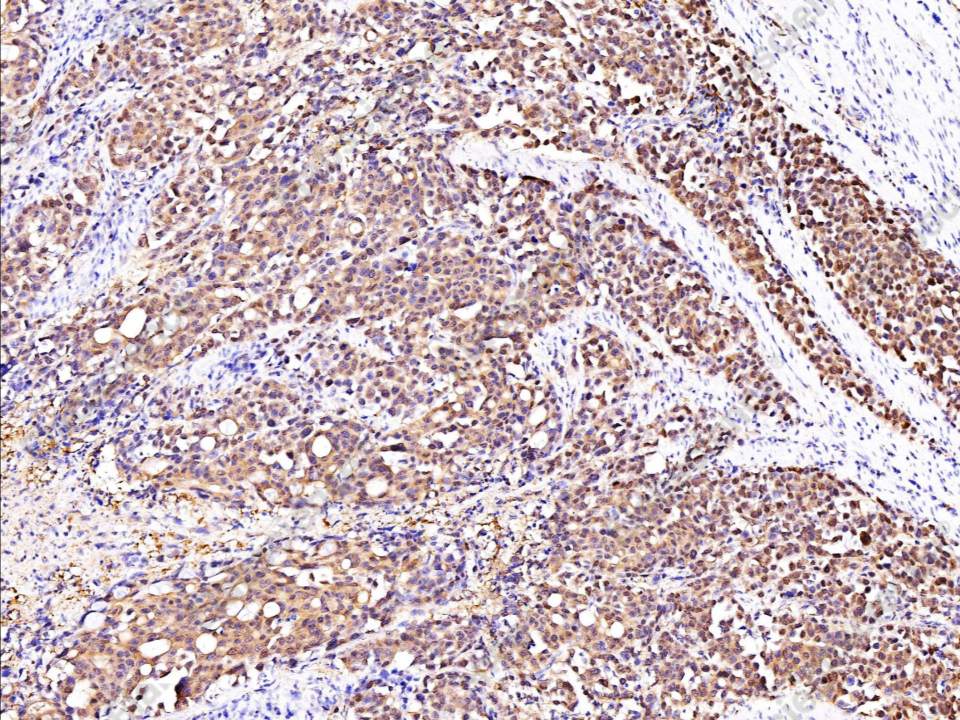 Recombinant GSTP1 Monoclonal Antibody - 1