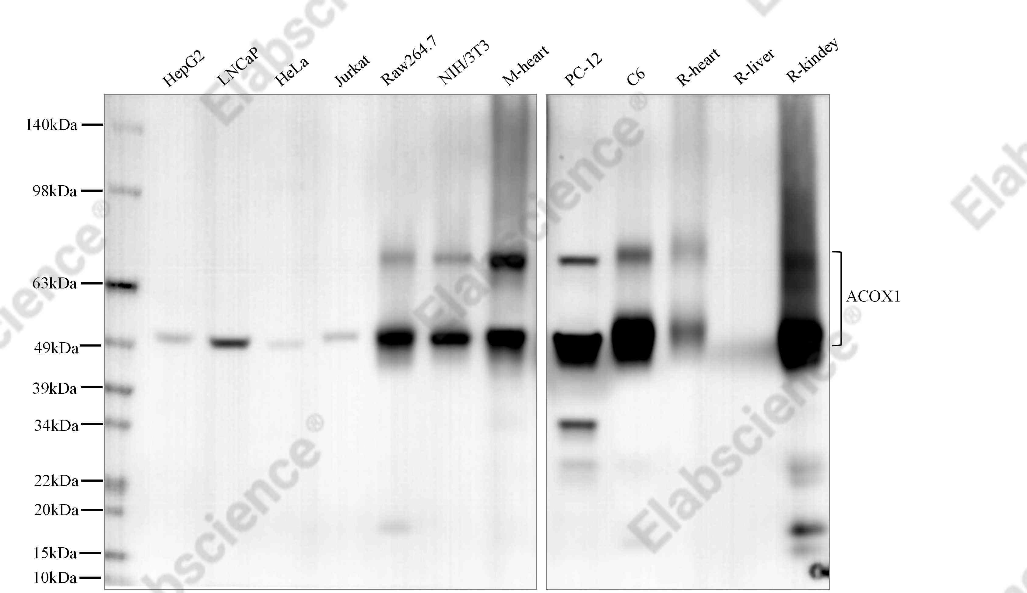 Recombinant ACOX1/AOX Monoclonal Antibody - 3